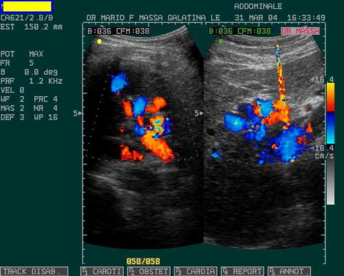 CAVERNOMA PORTALE